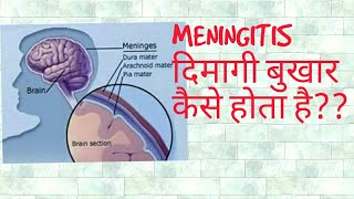 Meningitis in hindi [upl. by Araldo]