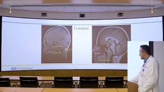 “Common Pitfalls in Chiari Operations”  Aria Fallah MD [upl. by Hamner630]