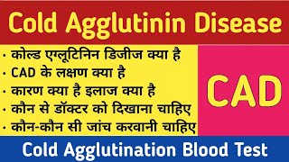 CAD in hindi  Cold Agglutinin Disease  Treatment Symptoms amp Price [upl. by Eigram330]