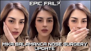 🔴Mika Salamanca Nose REVEAL EPIC FAIL😥  Trending [upl. by Aztilay]