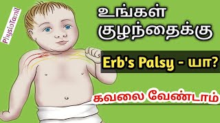 Erbs Palsy என்றால் என்னCausesSymptoms physiotherapy Treatment in TamilDrSasiDuraiPhysioTamil [upl. by Alwyn500]