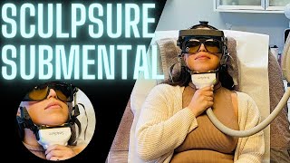 SCULPSURE SUBMENTAL CHIN PROCEDURE  FAT CONTOURING LASER [upl. by Wilda923]