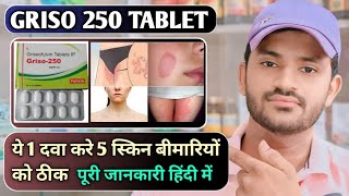 Griso 250 tablet uses dose benefits and Side effects full review in hindi [upl. by Tavia]