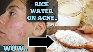 I Tested Rice Water for 1 Week Straight  SHOCKED BY THE RESULTS THIS IS HOW MY SKIN LOOKS NOW [upl. by Dorelle]