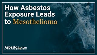 Asbestos Exposure  How It Leads to Mesothelioma Complete Guide [upl. by Binah]