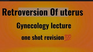 RETROVERSION OF UTERUS  Gynecology lecture [upl. by Adnalay]