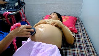 Severe abdominal pain unable to give birth  Checked by doctor and no signs of labor [upl. by Wakerly83]