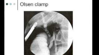 IntraOperative Imaging of the biliary system  Cholangiography [upl. by Crawford]