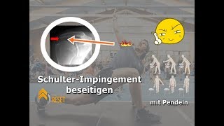 SchulterImpingement beseitigen  DIE Übung für schnelle Fortschritte [upl. by Sheryl]