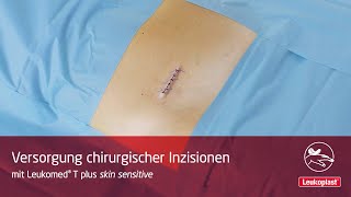 Leukoplast Leukomed T plus skin sensitive – Versorgung chirurgischer Inzisionen [upl. by Yatnuahc]