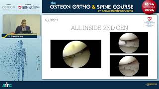 Δρ Βασίλειος Ι Σακελλαρίου  2ο Annual HandsOn quotThe Osteon amp Spine Course [upl. by Odnomyar]