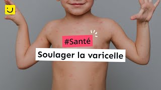 Soulager la varicelle [upl. by Onida]