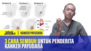 Kanker Payudara Gejala Penyebab dan Penanganannya  Kata Dokter 158 [upl. by Loferski]