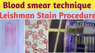 PERIPHERAL BLOOD SMEAR  HAEMATOLOGY LAB  LEISHMAN STAIN PHYSIOLOGY PRACTICALS [upl. by Finah]