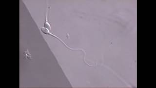 Sperm swimming in microscope field [upl. by Auburta]