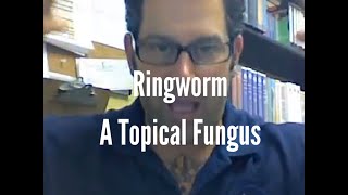 Ringworm A topical fungus [upl. by Gillead]