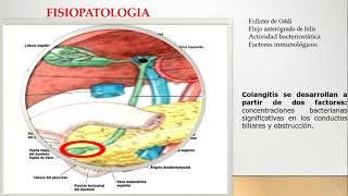 Colangitis aguda fisiopatologia [upl. by Alra260]