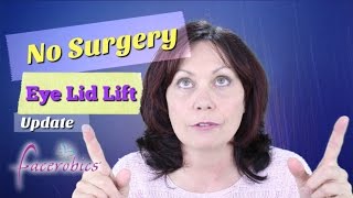 How to Get Rid of Droopy Eye Lids No Surgery Eye Lid Lift Hooded Eye Lid Lift  FACEROBICS® [upl. by Mich]