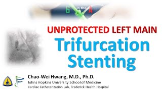 Left Main Trifurcation Stenting [upl. by Laurella]