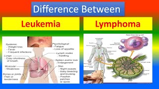 Difference between Leukemia and Lymphoma [upl. by Karly]