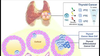 Non neoplastic diseases of the thyroid gland pathology quick recap by ASM Minds Team [upl. by Cudlip835]