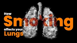 How Smoking affects your Lungs  You Must See This [upl. by Tnayrb]