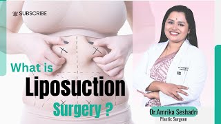 What is Liposuction in plastic surgery By Dr Amrika Seshadri plasticsurgeonskincare [upl. by Enelyt]