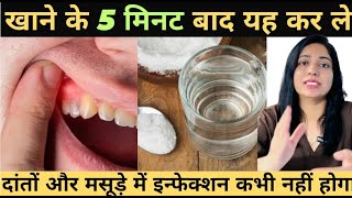 खाने के बाद ये Remedy अपनाये  दांत और मसूड़े में इन्फेक्शन कभी नहीं होगा  Healthy Gums And Teeth [upl. by Anuat]