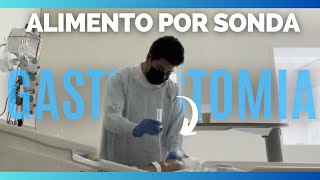 ¿COMO ADMINISTRAR una ALIMENTACION POR SONDA de GASTROSTOMIA  VIDEO PRACTICO [upl. by Ardnosal]