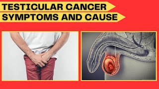 Testicular Cancer Symptoms and Causes of Testicular Cancer and Treatment Your Doctor [upl. by Marijo]