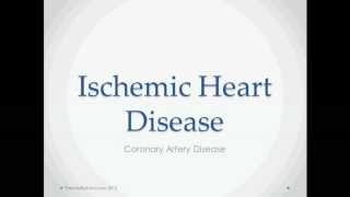 Ischemic Heart Disease  USMLE Step 2 Review [upl. by April]