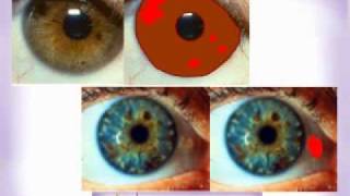 IntroToIridology Part2 [upl. by Kramer]