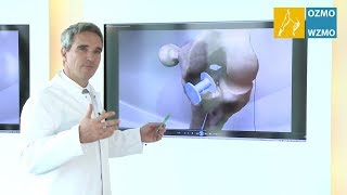 Prof Dr Diehl Kreuzband  Ursache Kreuzbandriss amp minimalinvasive Versorgungsmöglichkeiten [upl. by Eednac]