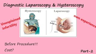 Laparoscopy amp Hysteroscopy Cost Test before Laparoscopy procedure se pehle kya hota hai [upl. by Leahcam]