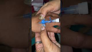 Cannula kaisa lgay 🤔cannula lgana seekho foryou hospital alone explore shortvideos dream [upl. by Oika937]