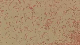 Moraganella morganii in Gram Staining [upl. by Anselm]