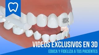 EDUCA A TUS PACIENTES con VIDEOS AMIGABLES odontológicos en 3D 😄 [upl. by Coonan]