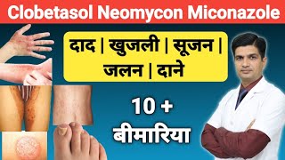 दाद खुजली को ठीक करने की क्रीम । Clobetasol Neomycin and Miconazole cream [upl. by Ailec]