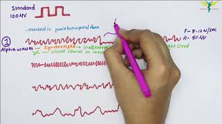 Electroencephalogram EEG  Waves  Physiology [upl. by Nosloc]