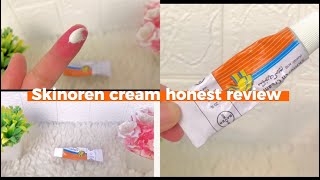 Skinoren cream honest review ✨ [upl. by Itsrejk]