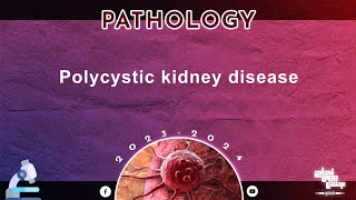 L  Polycystic kidney disease BNU Pathology [upl. by Critchfield]