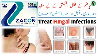 Zacon 100 mg capsule uses  Zacon capsule  itraconazole Capsules 100mg Uses  Fungal Infection [upl. by Suiram]