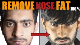 Mote Naak Ko Patla Karne Ka Tarika हिंदी How To REMOVE Nose Fat  100 Slim  Sharp Big Nose [upl. by Theodosia]