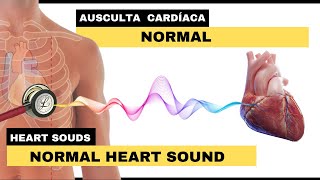 AUSCULTA CARDÍACA NORMAL  Normal Heart Sounds [upl. by Bathsheb951]