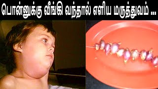 பொன்னுக்கு வீங்கி வந்தால் எளிய மருத்துவம்  Home Remedi For Mumps [upl. by Leschen354]