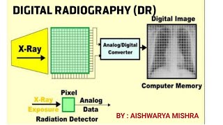 DIGITAL RADIOGRAPHY DR PART1  BY AISHWARYA MISHRA [upl. by Nilreb]