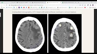 MRCP PART TWO PAST PAPERS JUN 2021 3 [upl. by Blasien]