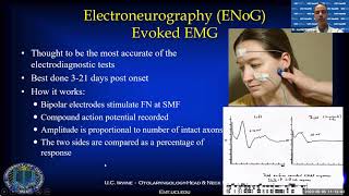 Facial nerve electrical testing  Dr Hamid Djalilian [upl. by Lacie]