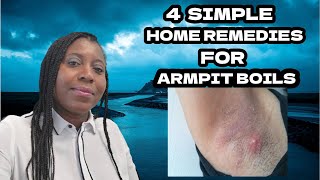 How to Get Rid of a Boil in the Armpit 4 Simple Natural Home Remedies [upl. by Gussie627]