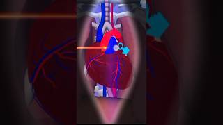 heart replacementheart burn procedureshorts [upl. by Aieka]